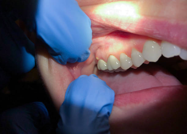 Best Same-Day Emergency Dental Services in Monterey, CA
